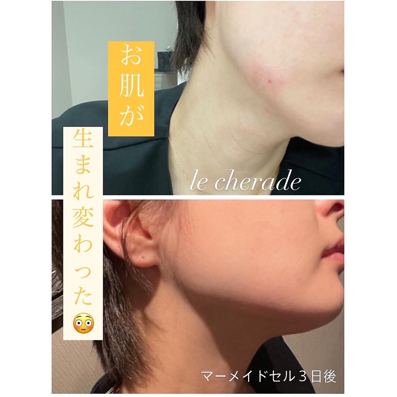 メンズ脱毛サロン Mr.Smooth 【ミスタースムース】の紹介画像