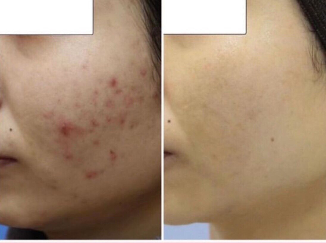 メンズ脱毛サロン Mr.Smooth 【ミスタースムース】の紹介画像