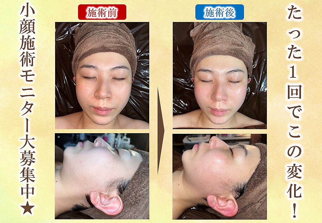 メンズ脱毛サロン Mr.Smooth 【ミスタースムース】の紹介画像