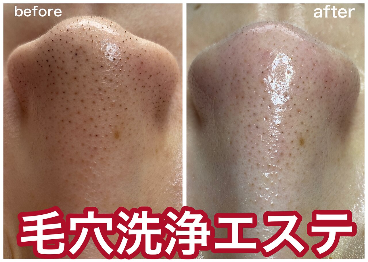 メンズ脱毛サロン Mr.Smooth 【ミスタースムース】の紹介画像