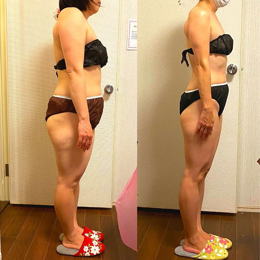 メンズ脱毛サロン Mr.Smooth 【ミスタースムース】の紹介画像