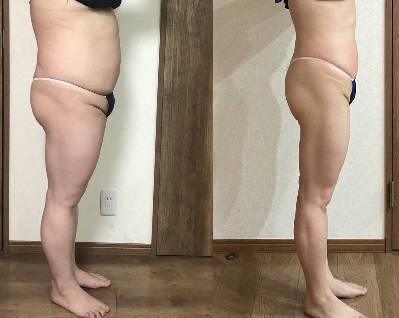 メンズ脱毛サロン Mr.Smooth 【ミスタースムース】の紹介画像