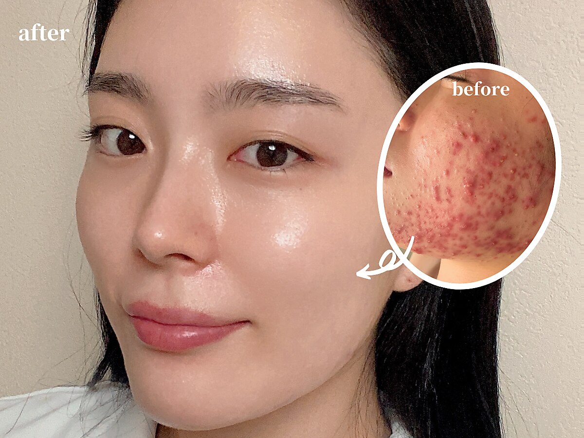 メンズ脱毛サロン Mr.Smooth 【ミスタースムース】の紹介画像