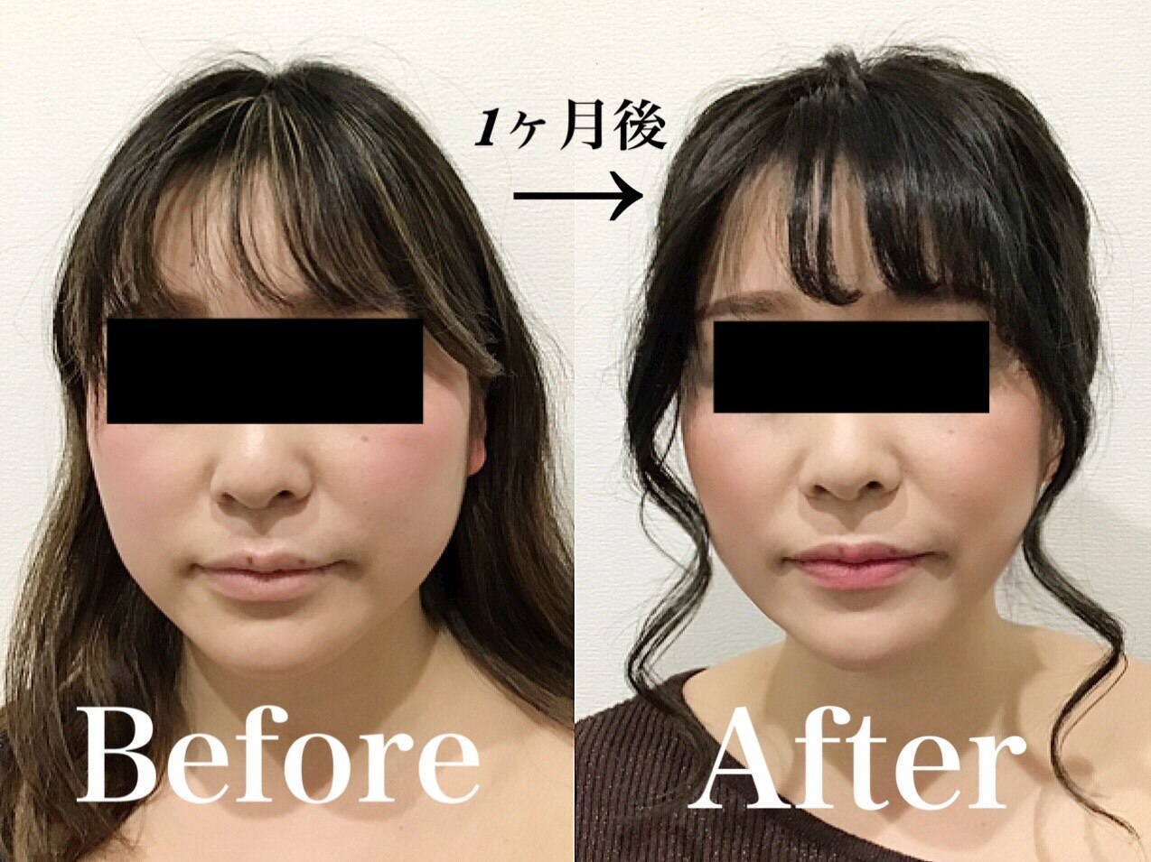 メンズ脱毛サロン Mr.Smooth 【ミスタースムース】の紹介画像