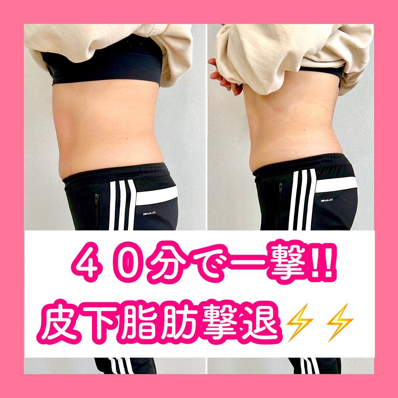 メンズ脱毛サロン Mr.Smooth 【ミスタースムース】の紹介画像