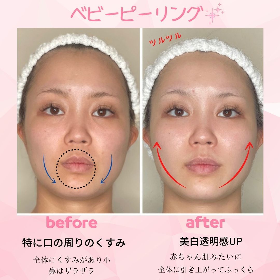 メンズ脱毛サロン Mr.Smooth 【ミスタースムース】の紹介画像