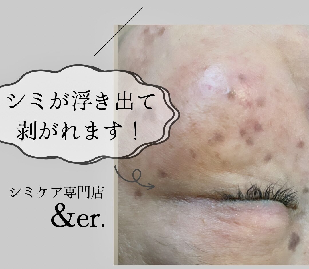 アンダー(&er.)の紹介画像