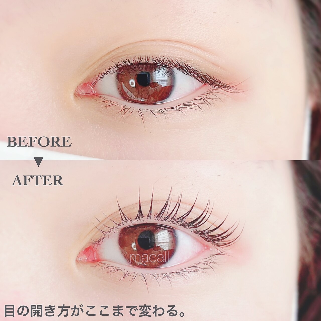 メンズ脱毛サロン Mr.Smooth 【ミスタースムース】の紹介画像