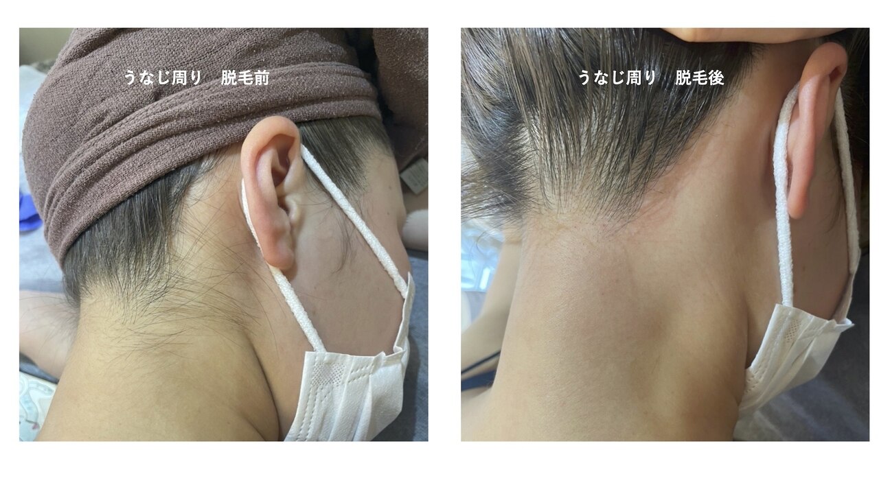 メンズ脱毛サロン Mr.Smooth 【ミスタースムース】の紹介画像