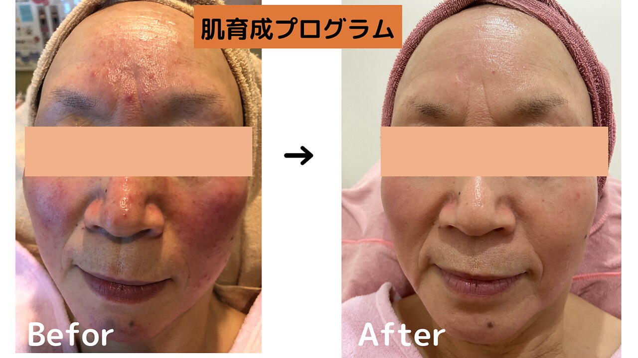 メンズ脱毛サロン Mr.Smooth 【ミスタースムース】の紹介画像