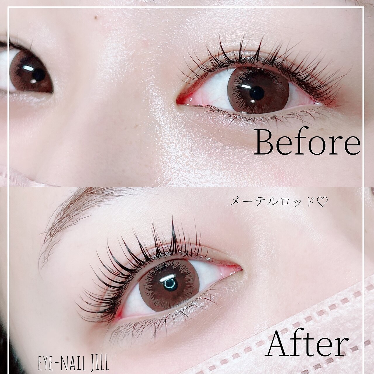 メンズ脱毛サロン Mr.Smooth 【ミスタースムース】の紹介画像