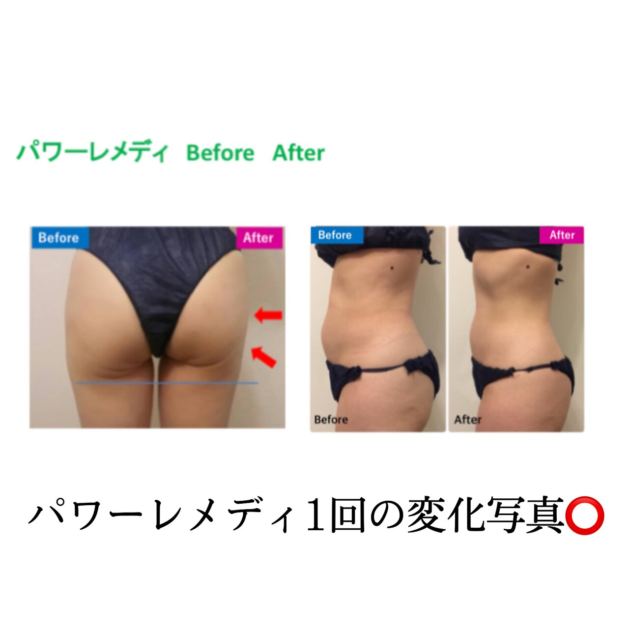 メンズ脱毛サロン Mr.Smooth 【ミスタースムース】の紹介画像