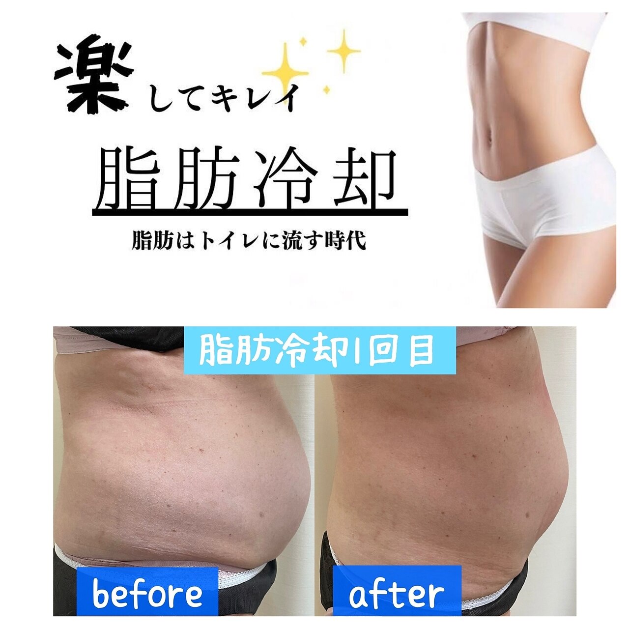 メンズ脱毛サロン Mr.Smooth 【ミスタースムース】の紹介画像