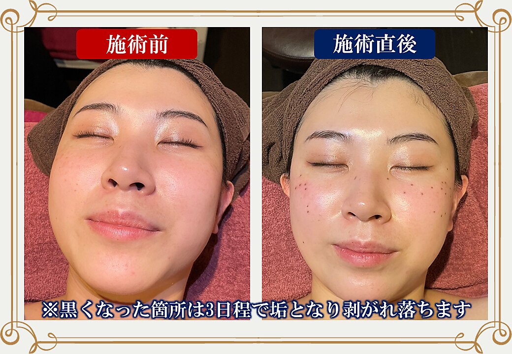 メンズ脱毛サロン Mr.Smooth 【ミスタースムース】の紹介画像