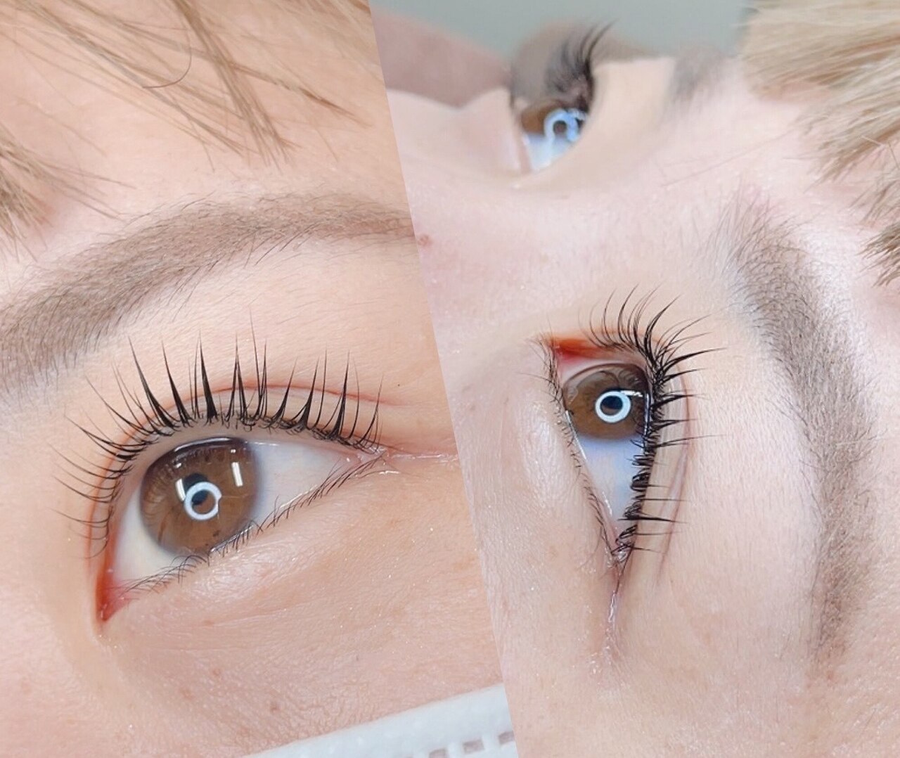 メンズ脱毛サロン Mr.Smooth 【ミスタースムース】の紹介画像