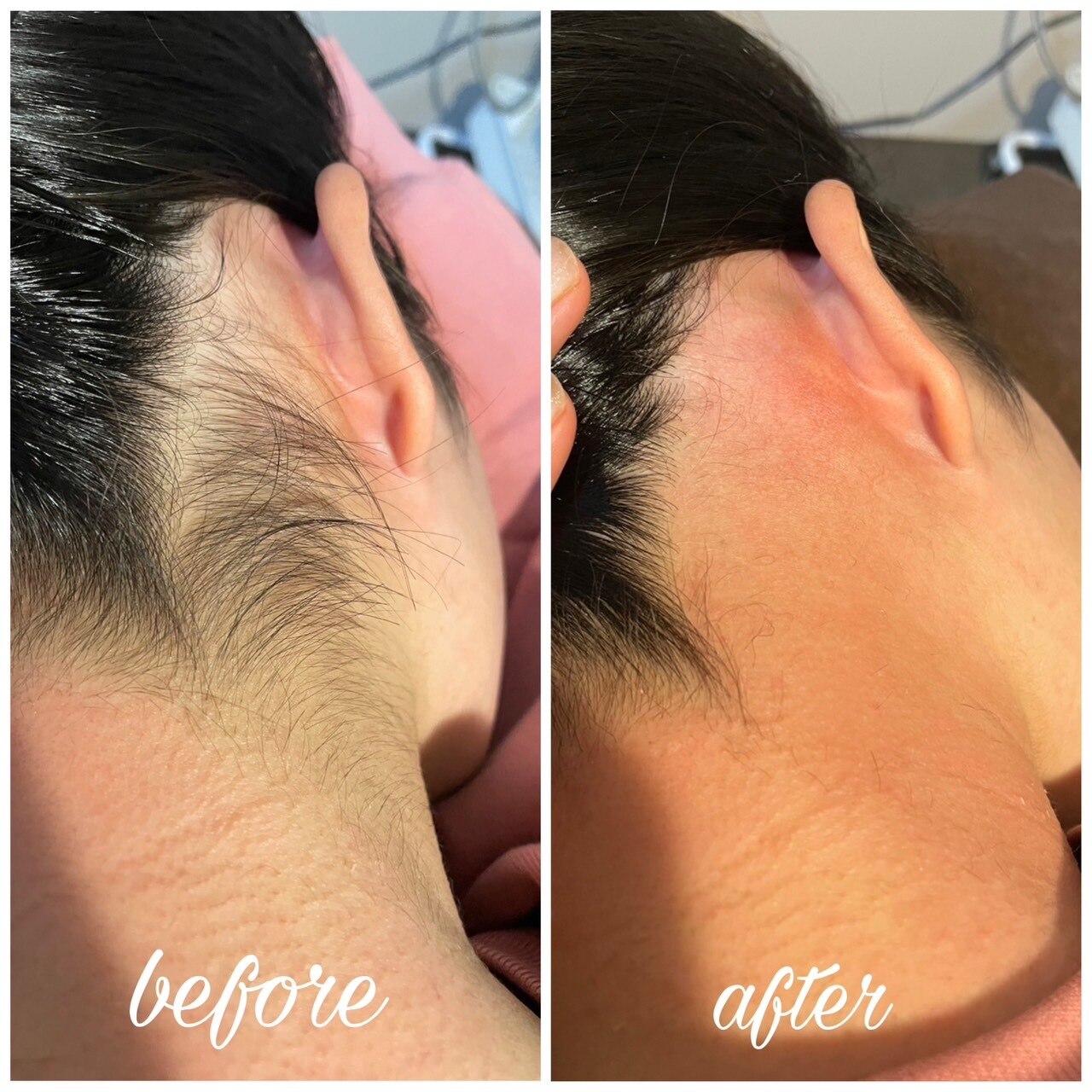 メンズ脱毛サロン Mr.Smooth 【ミスタースムース】の紹介画像