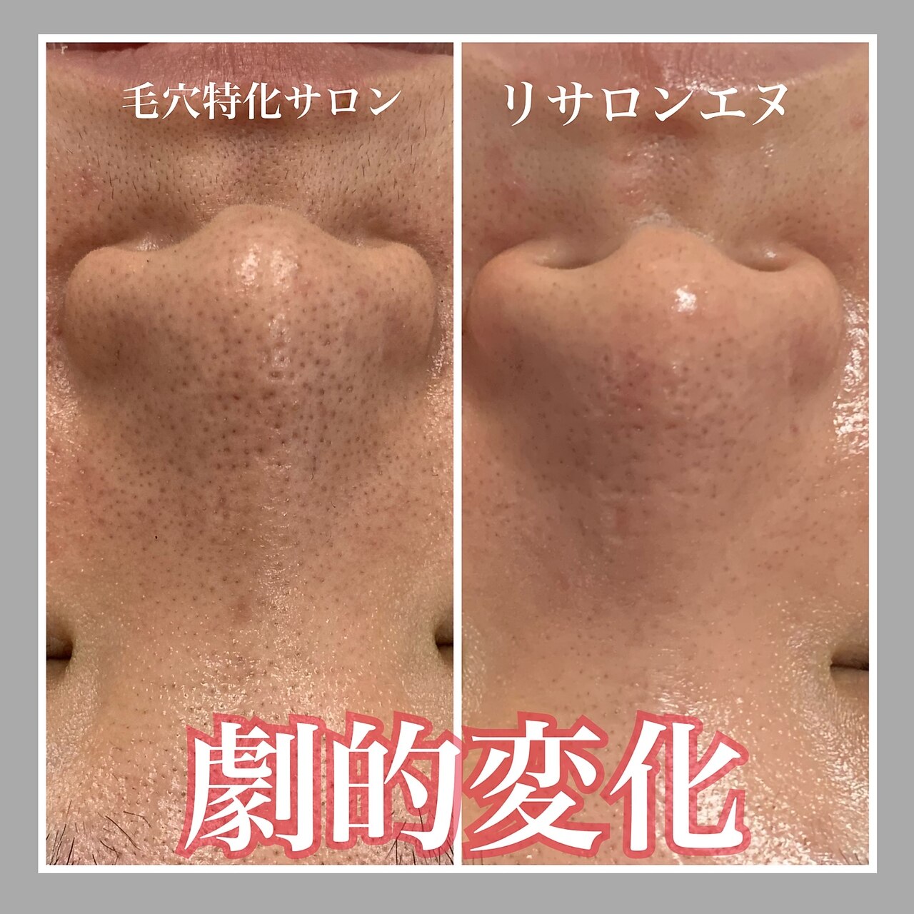 メンズ脱毛サロン Mr.Smooth 【ミスタースムース】の紹介画像