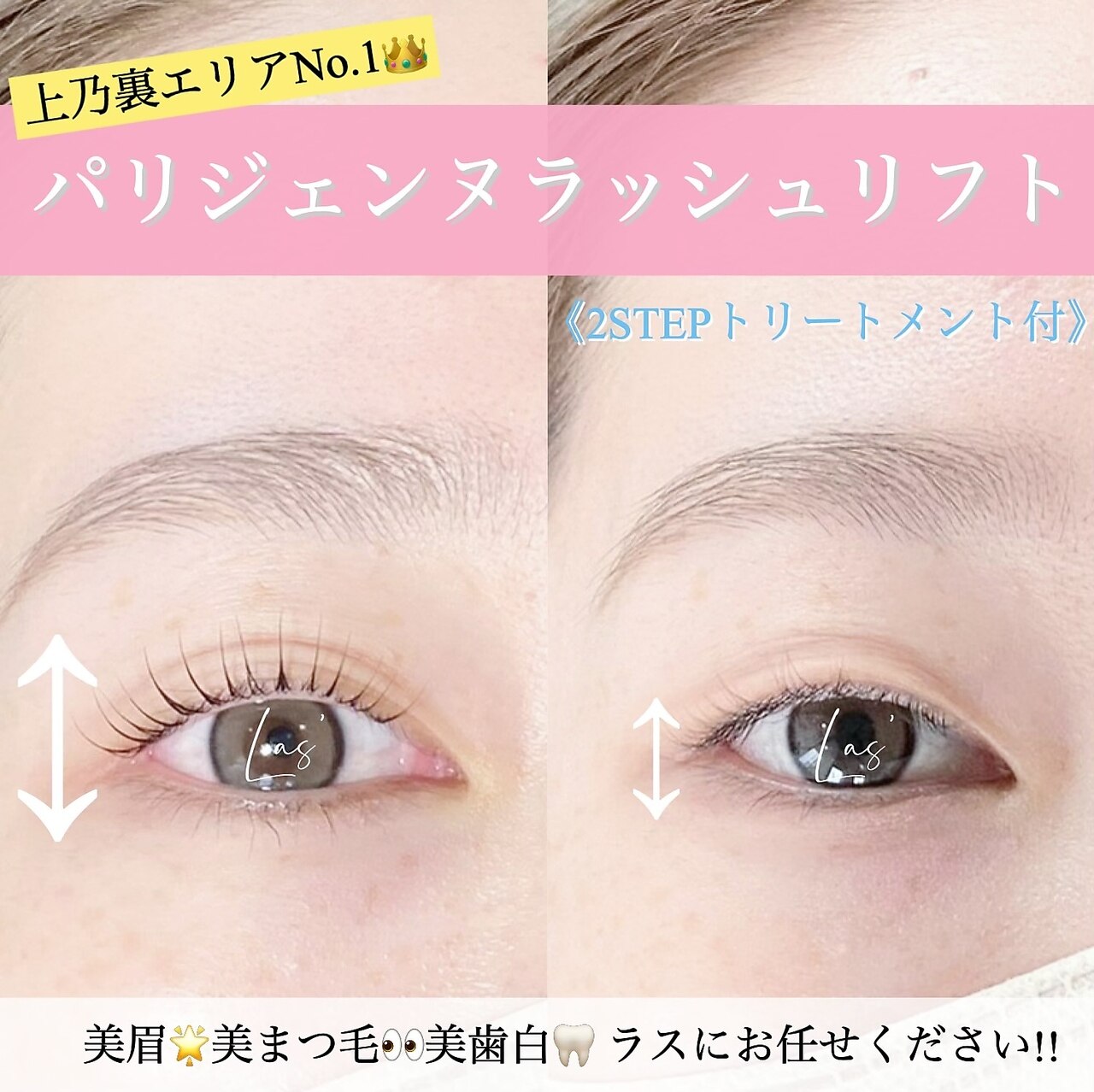 メンズ脱毛サロン Mr.Smooth 【ミスタースムース】の紹介画像