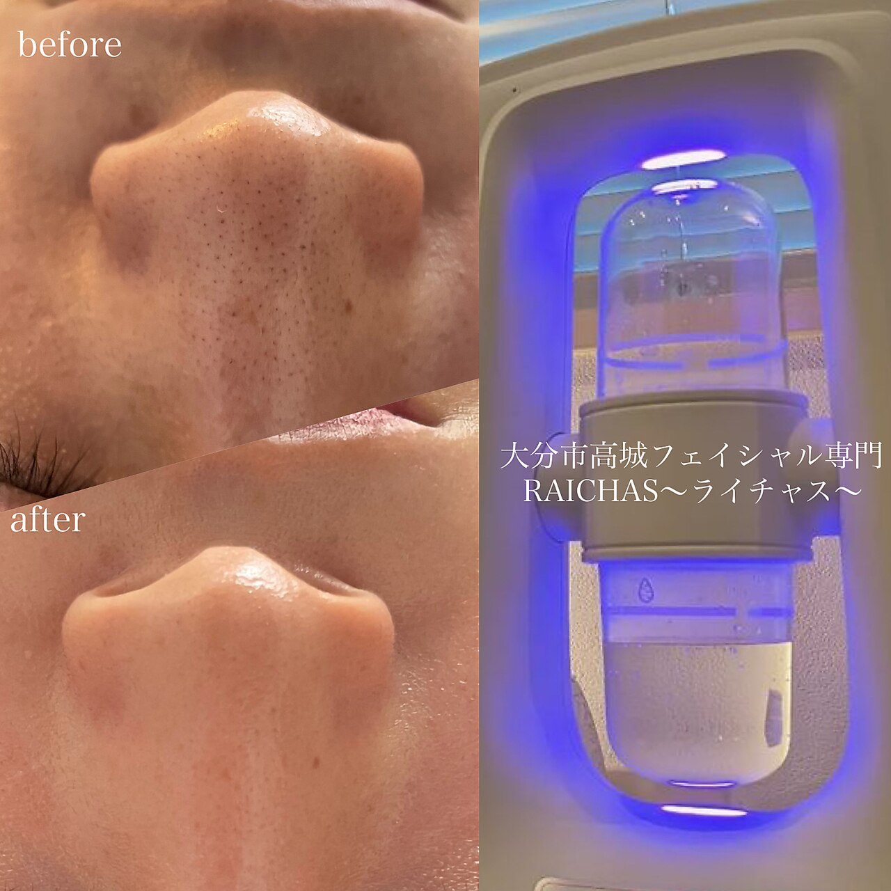 メンズ脱毛サロン Mr.Smooth 【ミスタースムース】の紹介画像