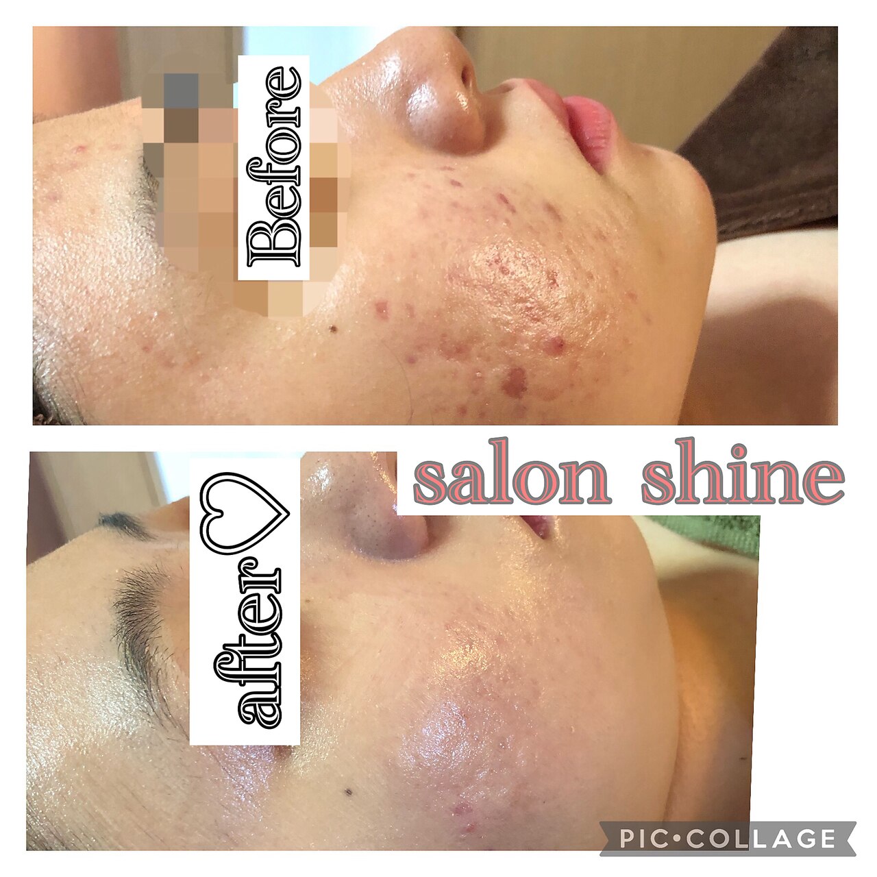 メンズ脱毛サロン Mr.Smooth 【ミスタースムース】の紹介画像