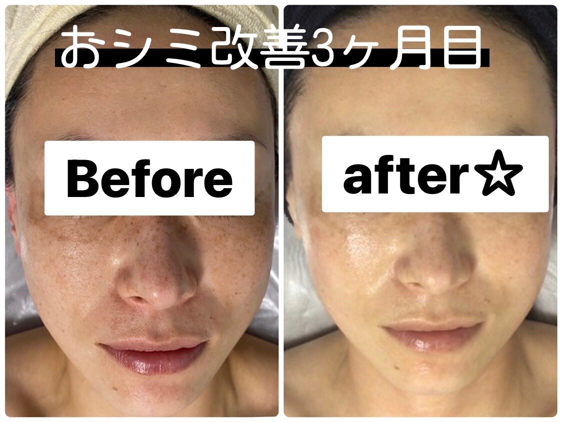 メンズ脱毛サロン Mr.Smooth 【ミスタースムース】の紹介画像