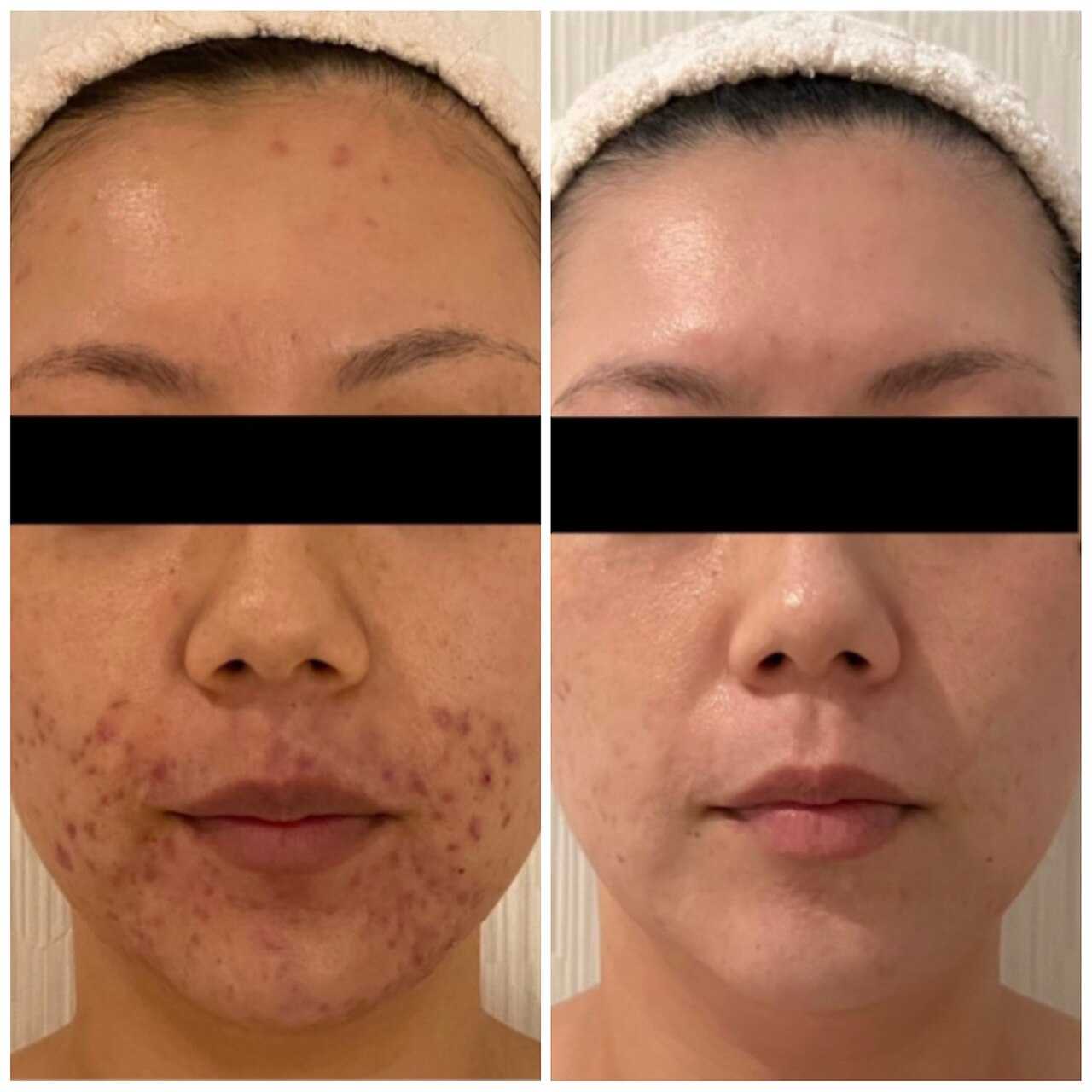 メンズ脱毛サロン Mr.Smooth 【ミスタースムース】の紹介画像