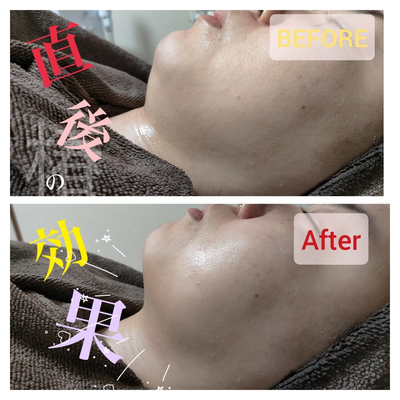 メンズ脱毛サロン Mr.Smooth 【ミスタースムース】の紹介画像