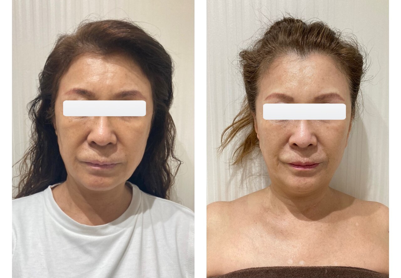 メンズ脱毛サロン Mr.Smooth 【ミスタースムース】の紹介画像