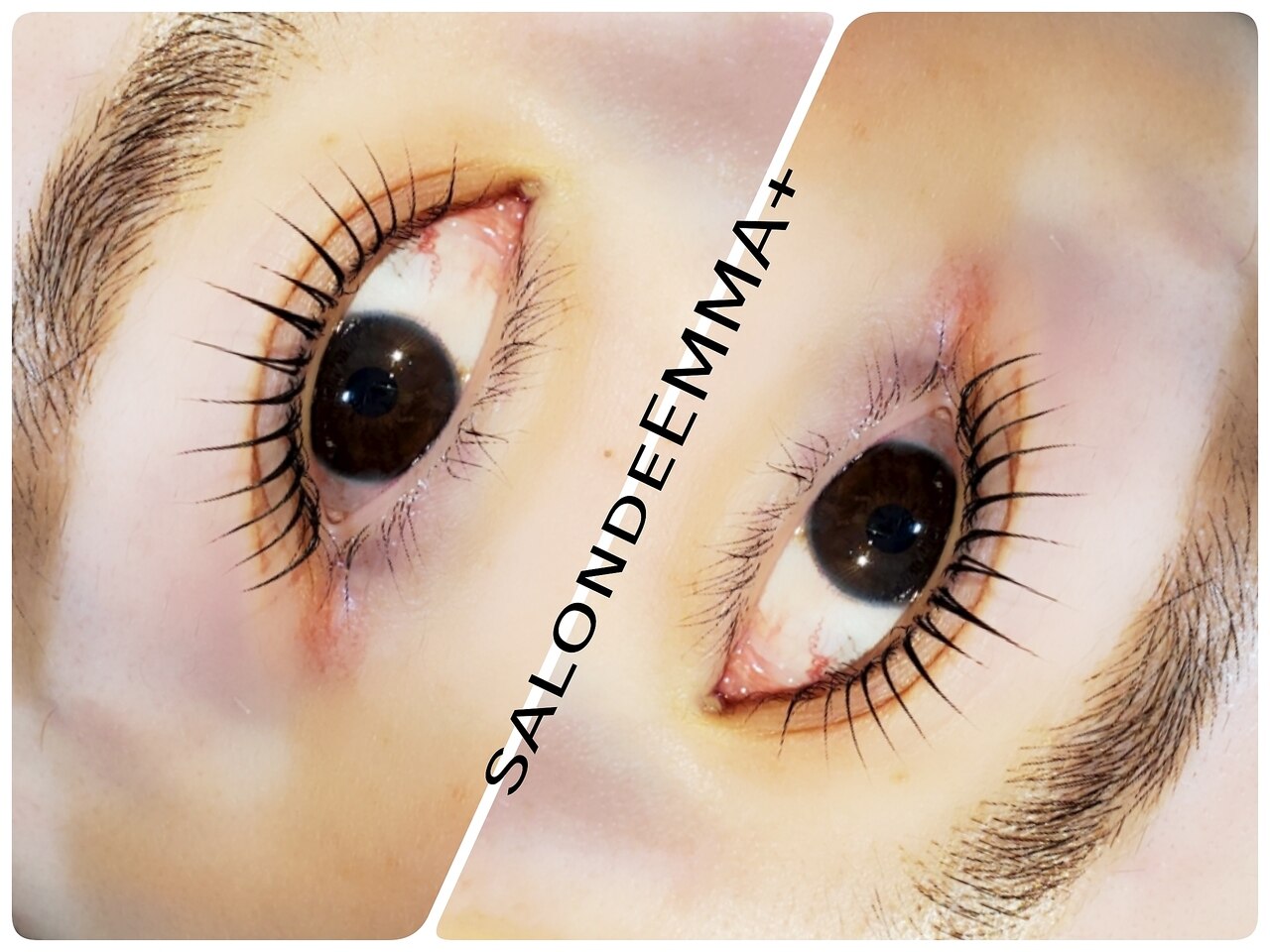 メンズ脱毛サロン Mr.Smooth 【ミスタースムース】の紹介画像