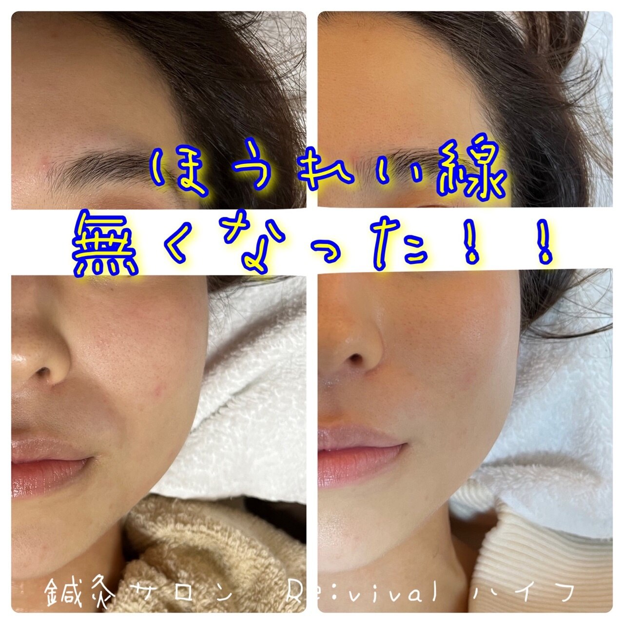 メンズ脱毛サロン Mr.Smooth 【ミスタースムース】の紹介画像