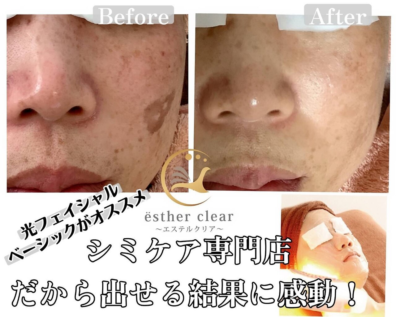 エステルクリア(esther clear)の紹介画像