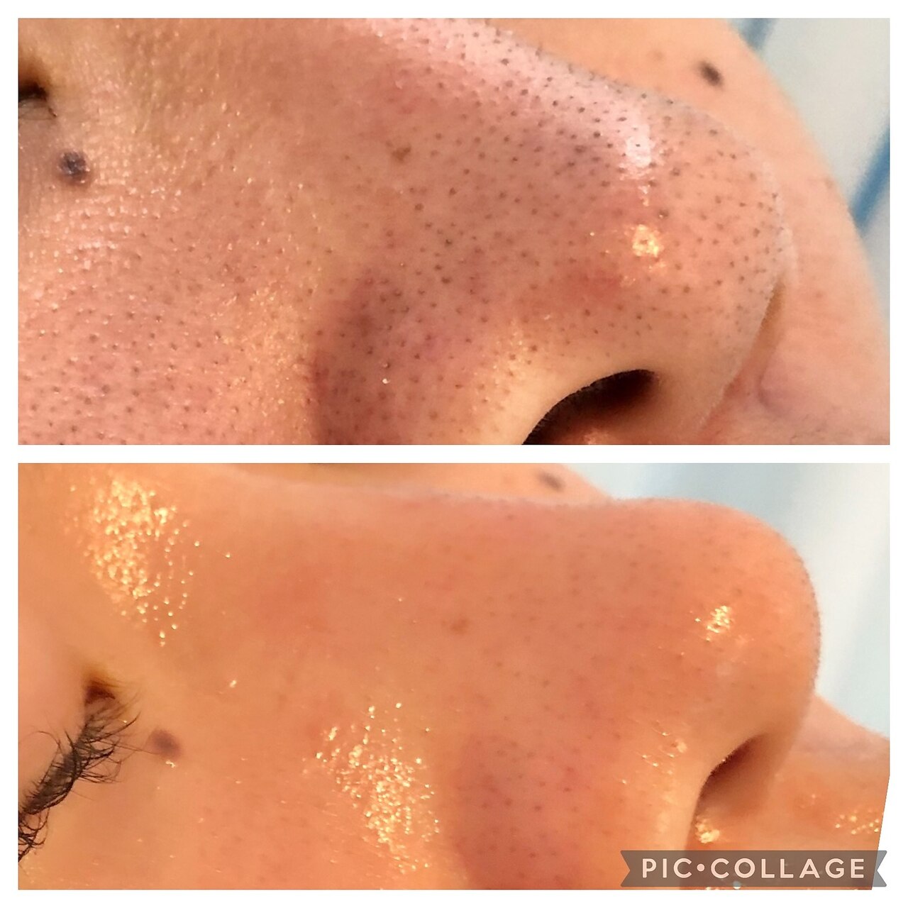 メンズ脱毛サロン Mr.Smooth 【ミスタースムース】の紹介画像