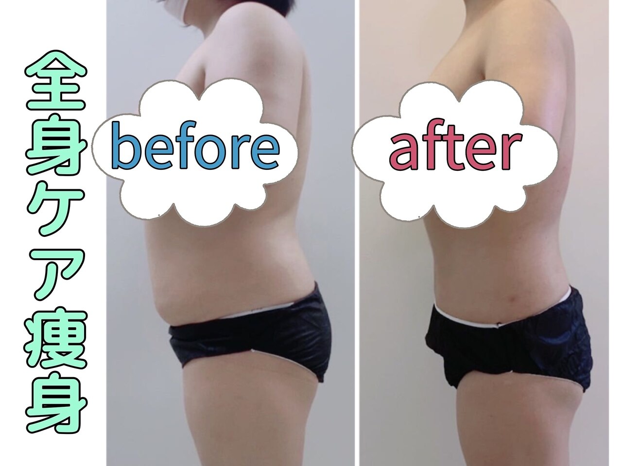 メンズ脱毛サロン Mr.Smooth 【ミスタースムース】の紹介画像