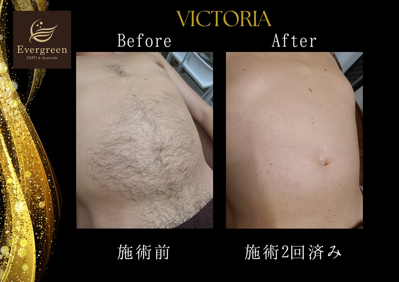 メンズ脱毛サロン Mr.Smooth 【ミスタースムース】の紹介画像