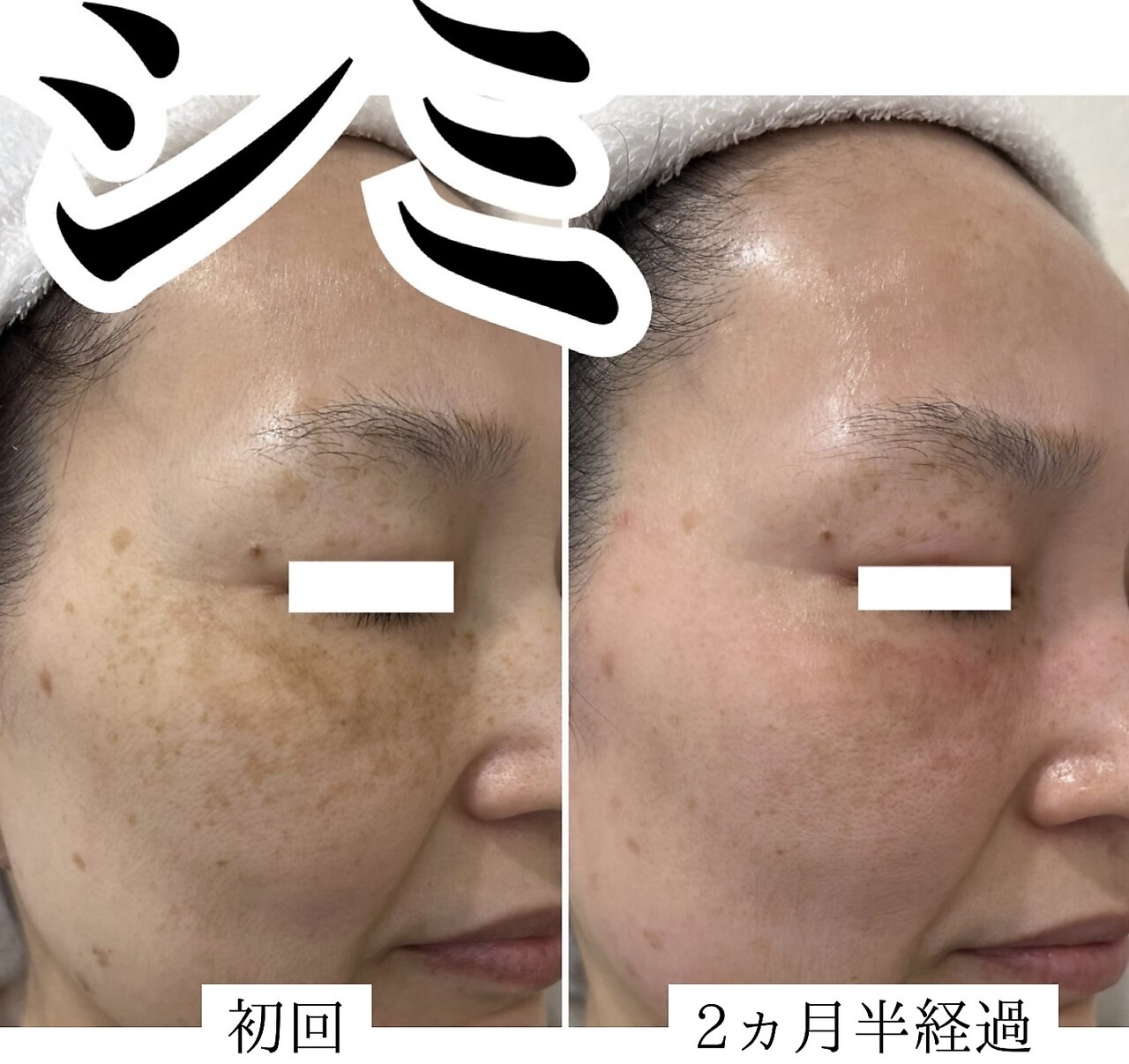 ハウオリ(HAUOLI)の紹介画像