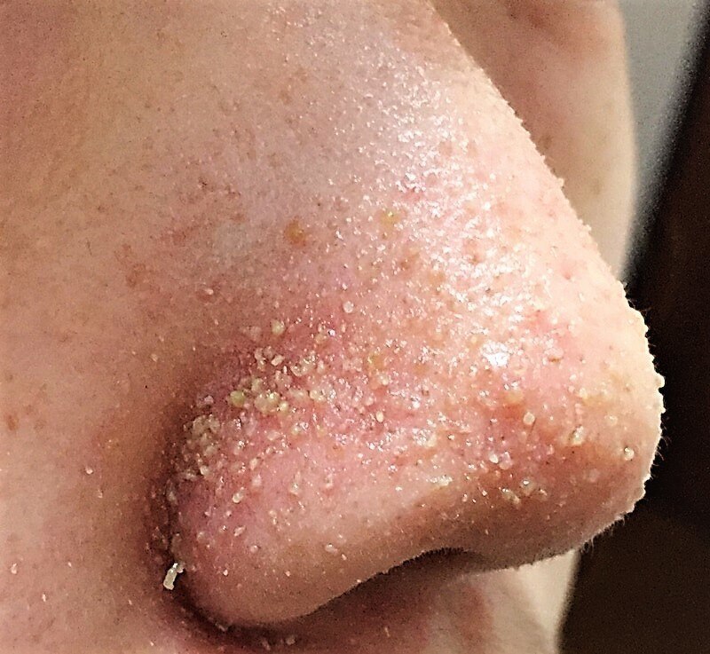 ピアリーノ(Pialino)の紹介画像