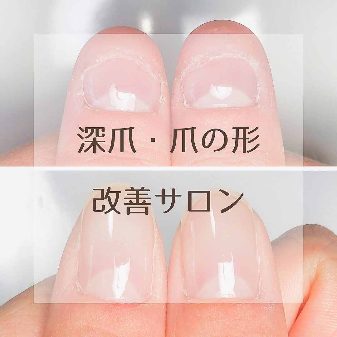 キット(KIT)の紹介画像