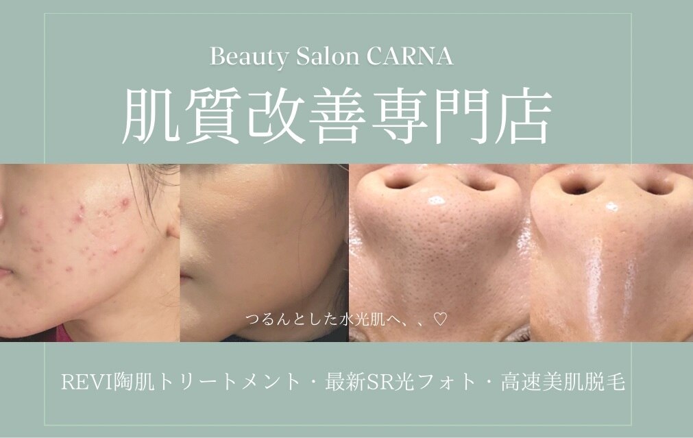 カルナ(CARNA)の紹介画像