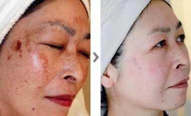 グラン ソレイユ(GRAN SOLEIL)の紹介画像