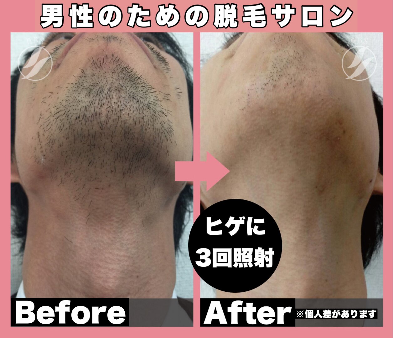 ルーモ(LUMO)の紹介画像