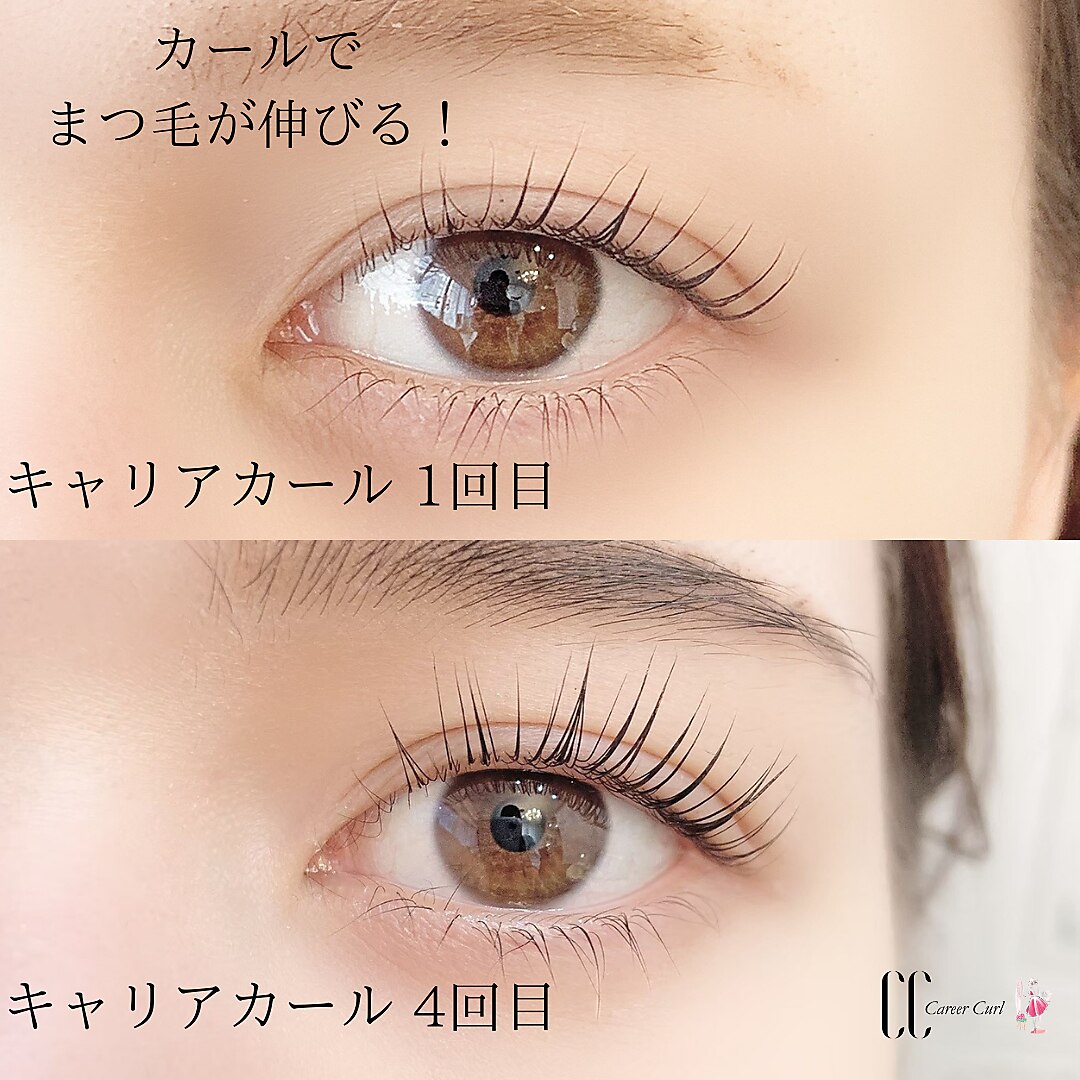 メンズ脱毛サロン　Mr.Smooth　【ミスタースムース】の紹介画像