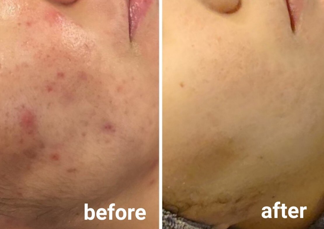 メンズ脱毛サロン Mr.Smooth 【ミスタースムース】の紹介画像