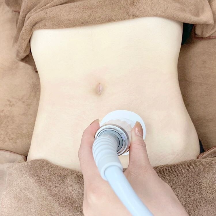 オルカ(Orca)の紹介画像