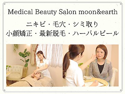 ムーンアンドアース(moon&earth)の紹介画像