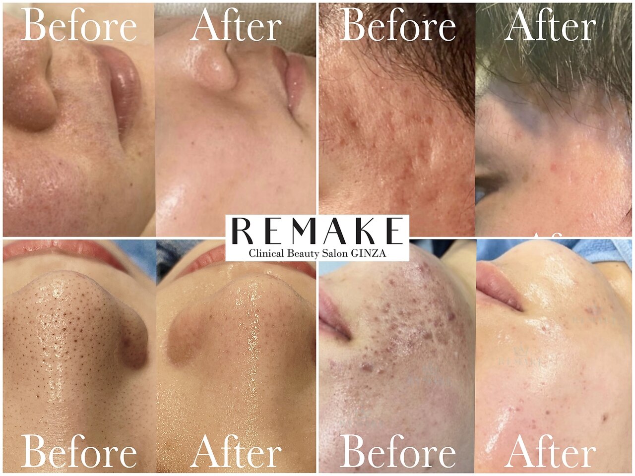 リメイク 東京 銀座店(REMAKE)の紹介画像