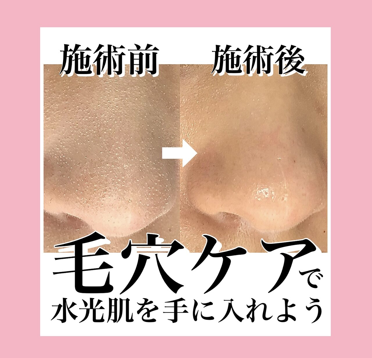 ベアトリーチェ(Beatrice)の紹介画像