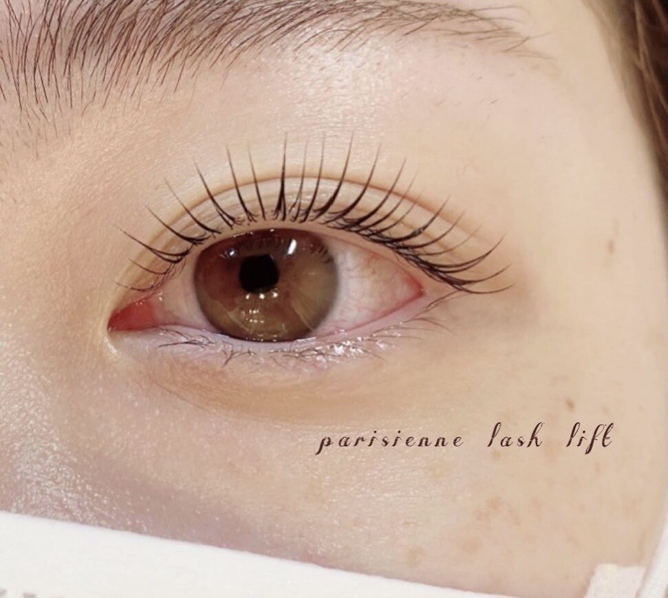 アネックスアイズの紹介画像