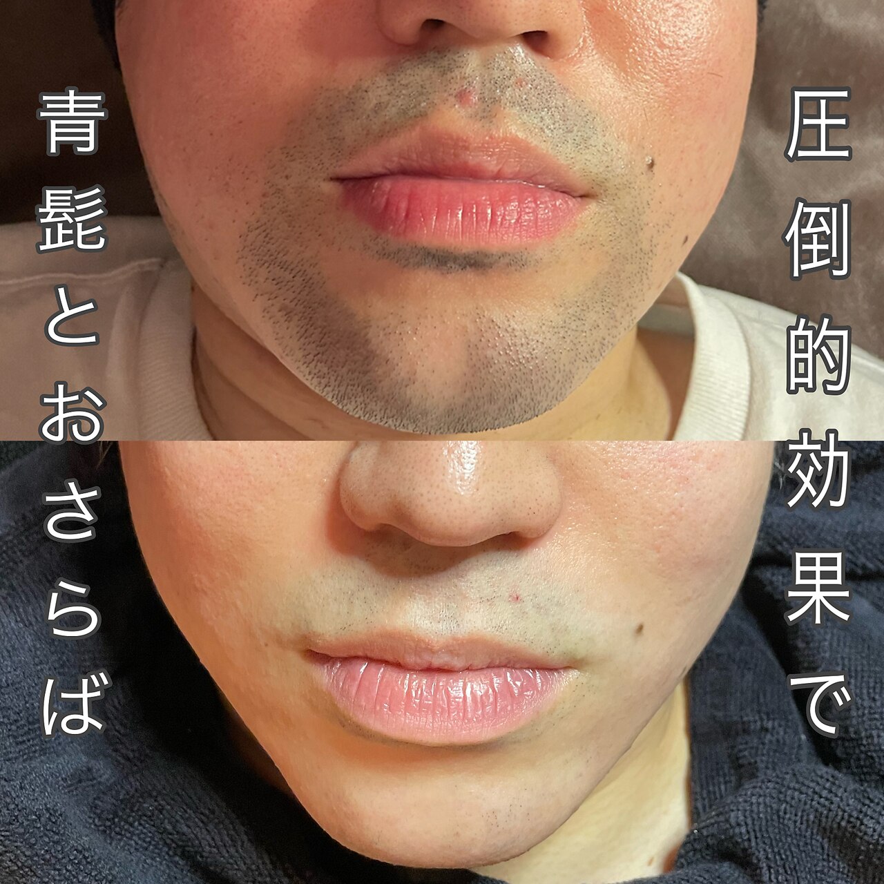 メンズ脱毛サロン　Mr.Smooth　【ミスタースムース】の紹介画像