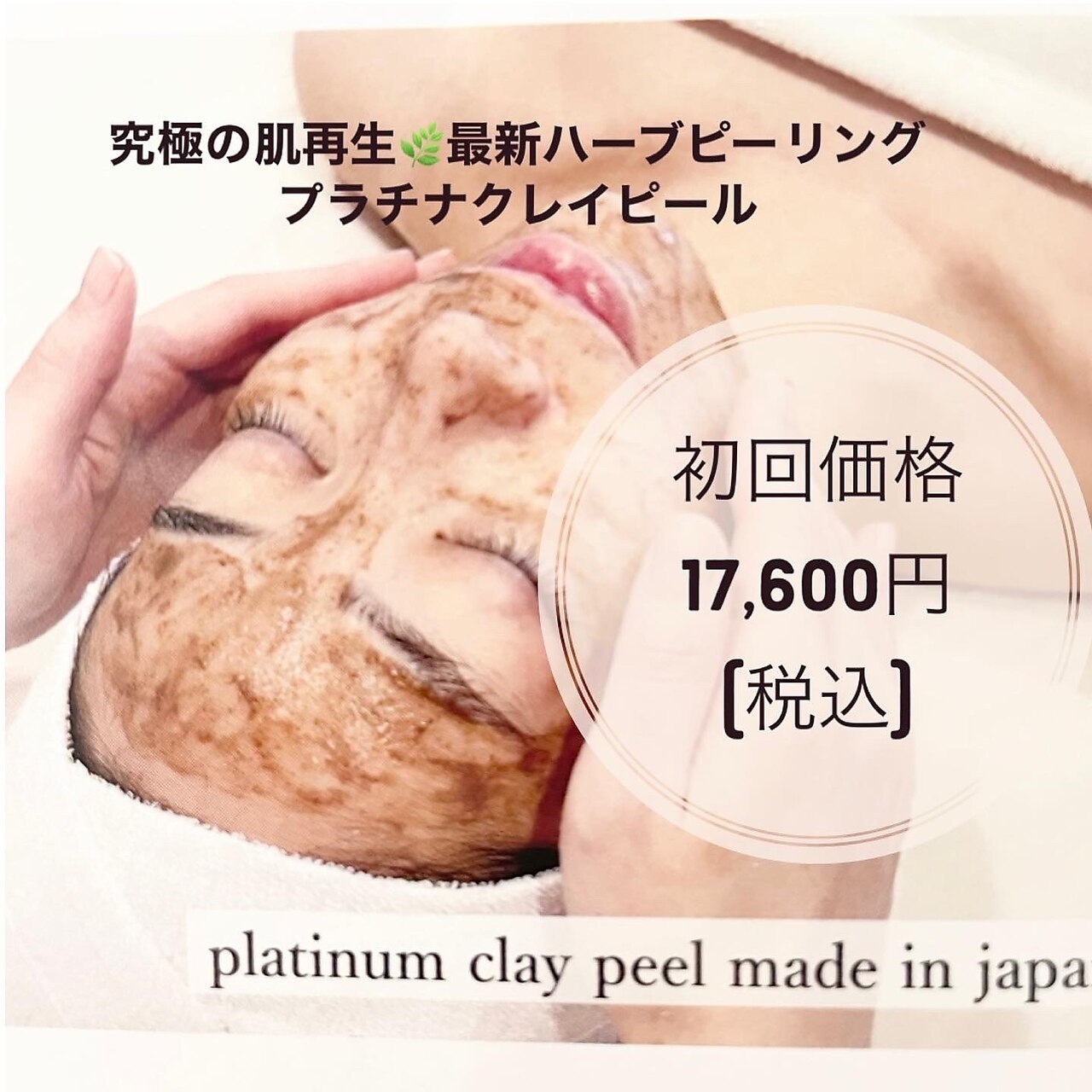 キャス(KYAS)の紹介画像