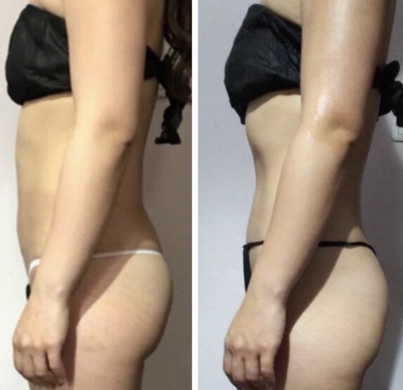 メンズ脱毛サロン Mr.Smooth 【ミスタースムース】の紹介画像